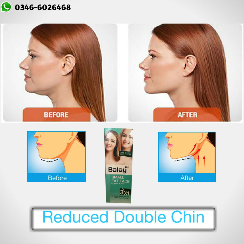 Balry / Balay Small Fat Face Cream (200ml) - Double Chin Reduction & Facial Slimming Cream