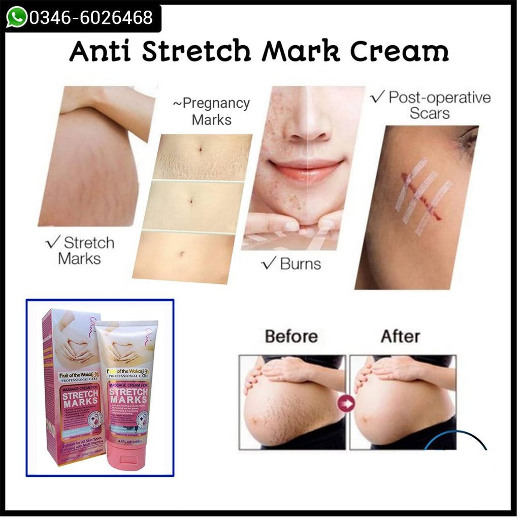 Wokali Maternity Stretch Mark Removal Cream (130ml) - Anti Stretch Mark Massage Cream