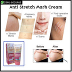 Wokali Maternity Stretch Mark Removal Cream (130ml) - Anti Stretch Mark Massage Cream