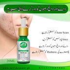 ACNE & SCARS SERUM | 20ML