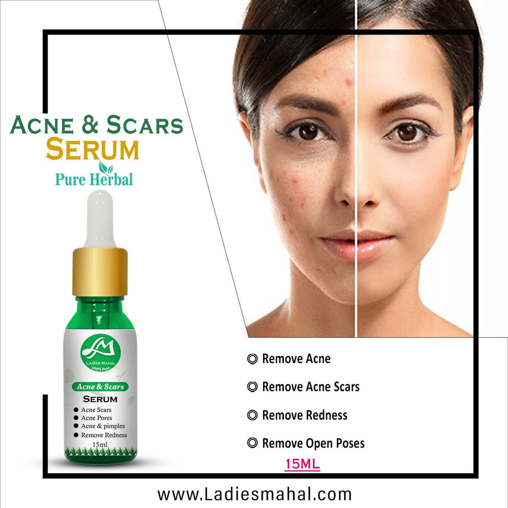 ACNE & SCARS SERUM | 20ML